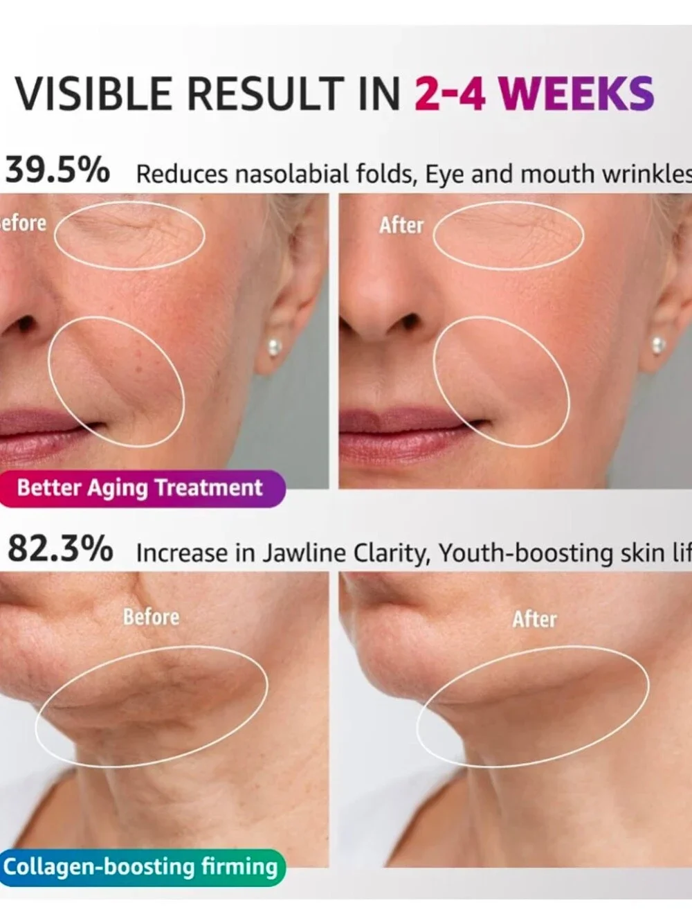 Red Light Therapy for Face and Neck